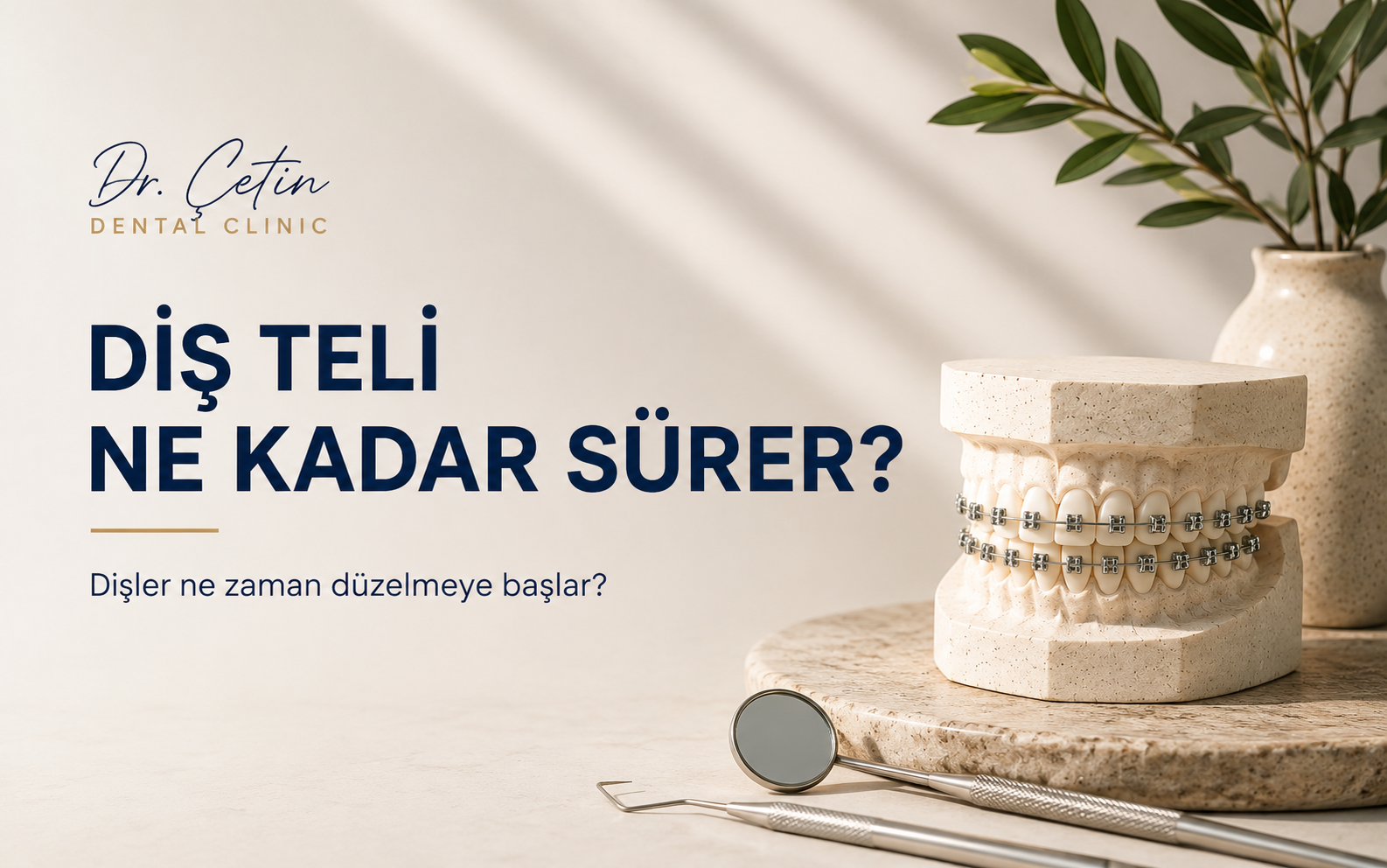 Diş Teli Ne Kadar Sürer? Dişler Ne Zaman Düzelmeye Başlar?