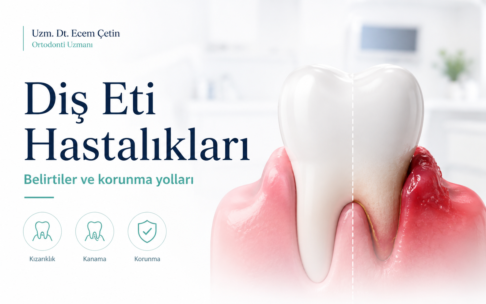 Diş Eti Hastalıkları