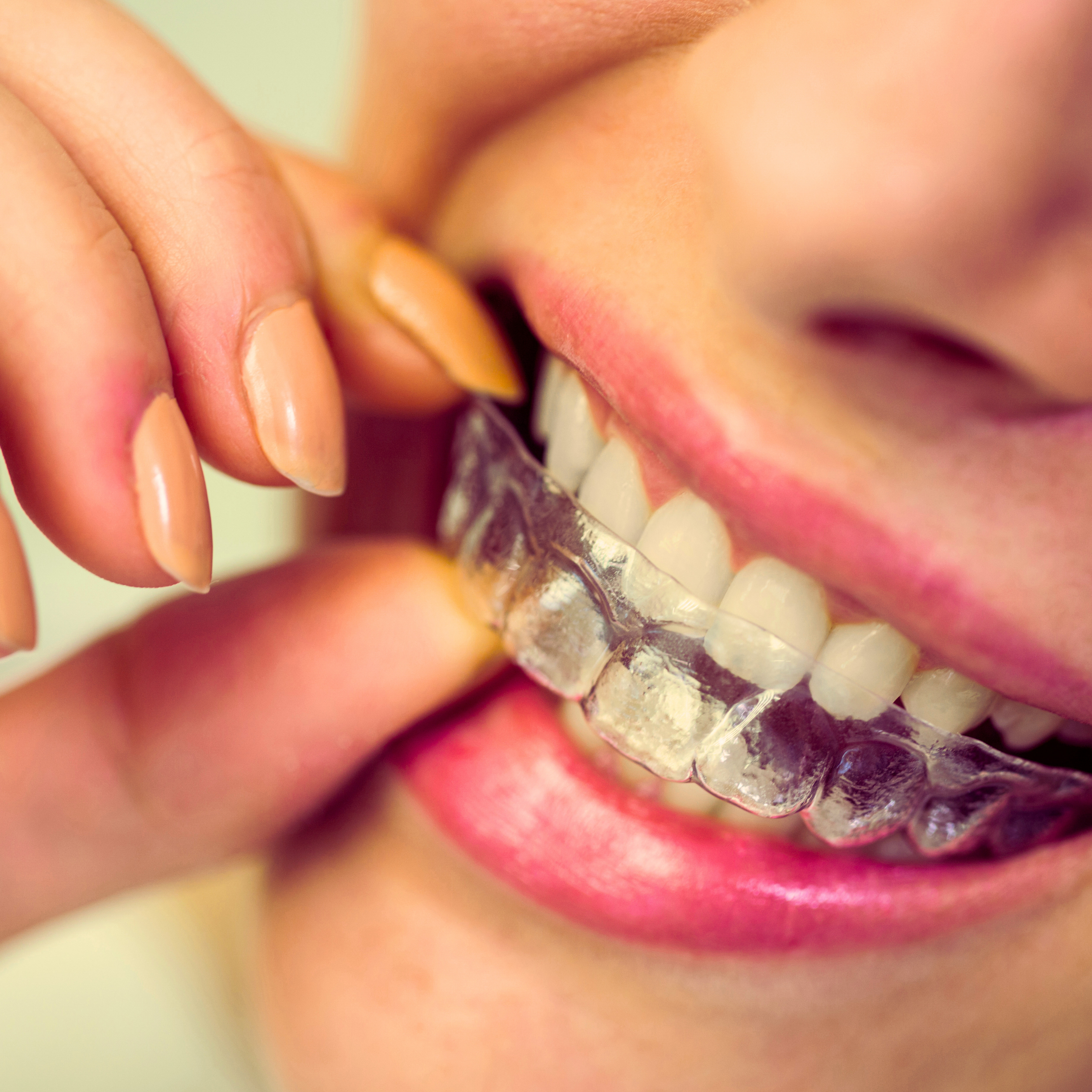 Yetişkinlerde Ortodontik Tedavi