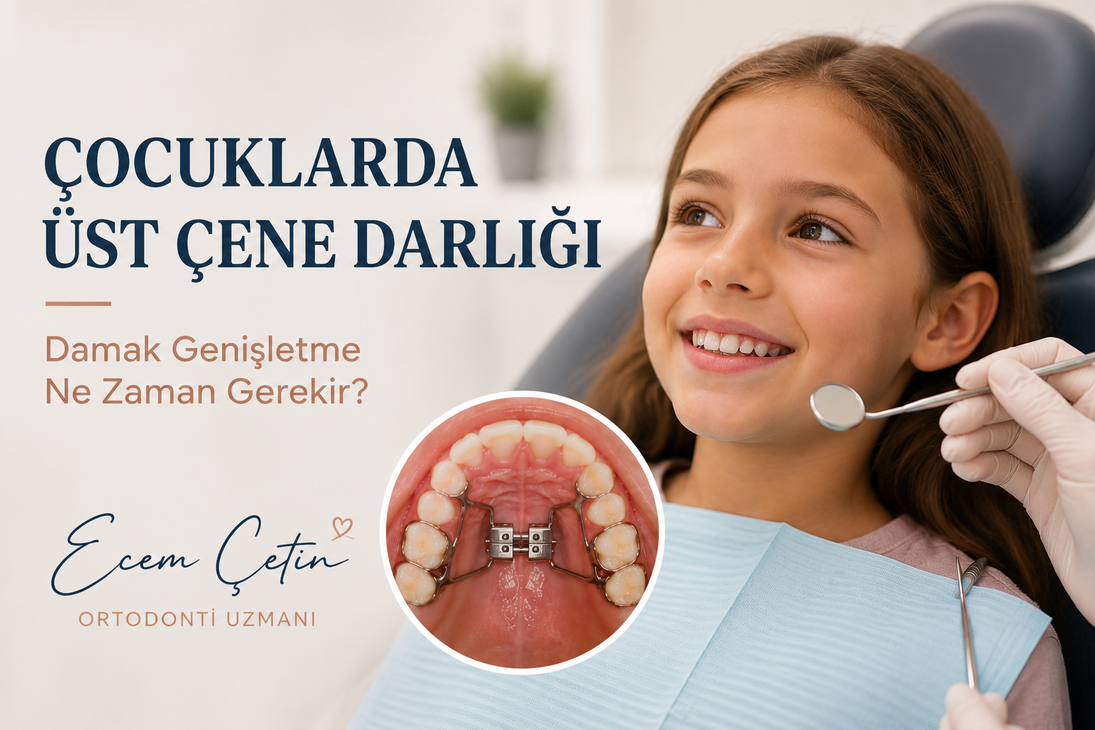 Çocuklarda Üst Çene Darlığı